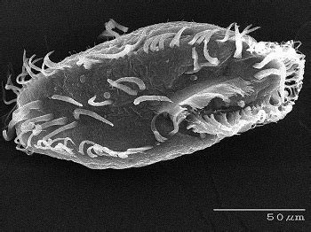  Streblomastix: ¡Un Protista Con Cilia Que Te Dejará Boquiabierto!