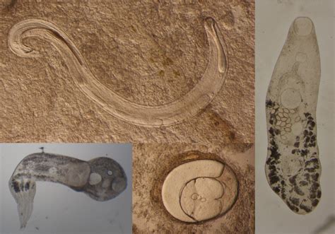  Yorkshire Trematode: This Tiny Parasite Lurks in Your Backyard Bird Feeder!